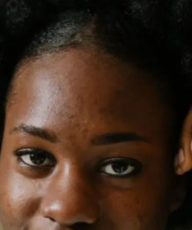 une femme africaine avec des point noire crédit photo: @AleksandarNakic