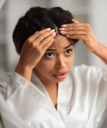 une femme ayant des pellicules
