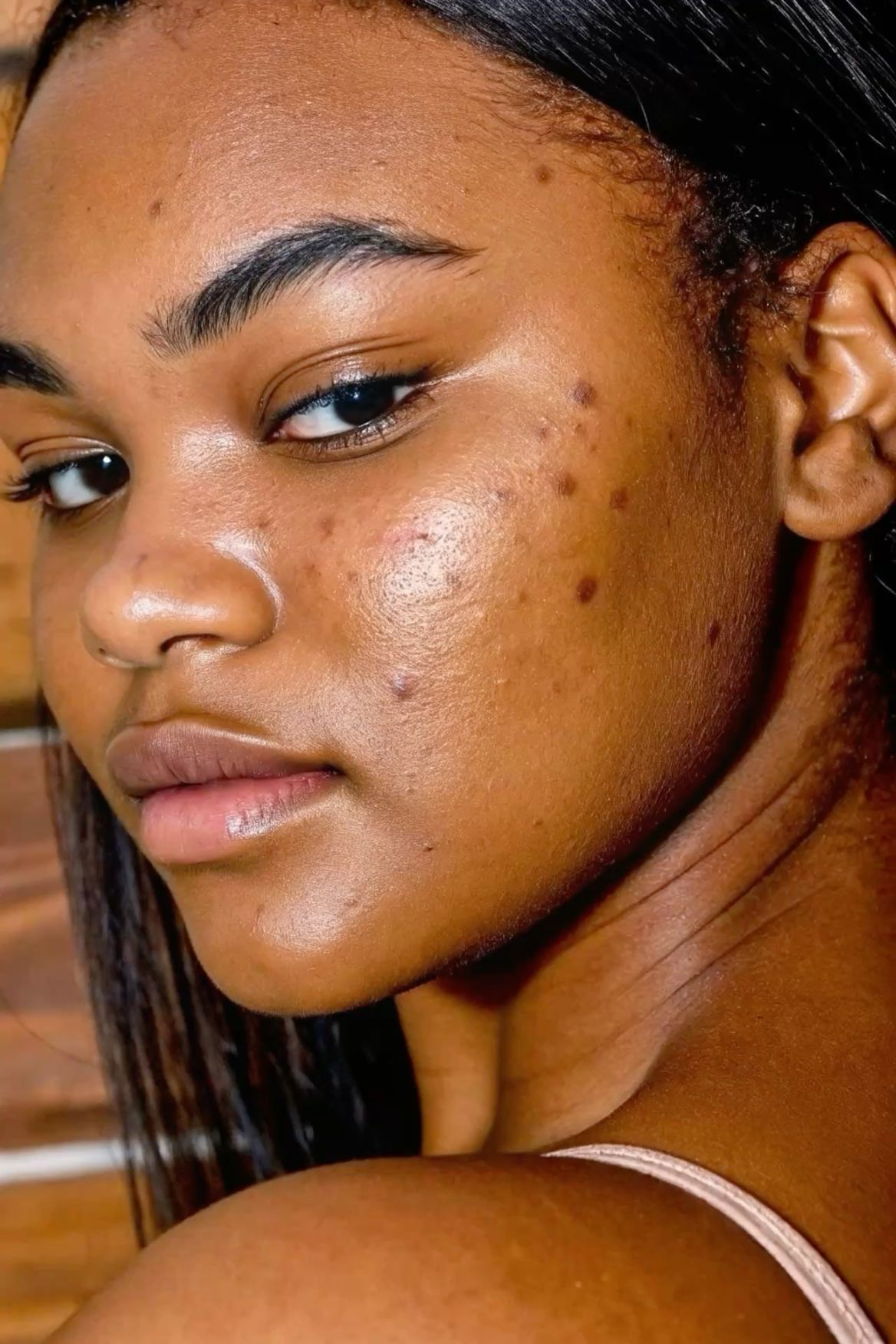 Femme avec des points noirs crédit photo: @pinterest